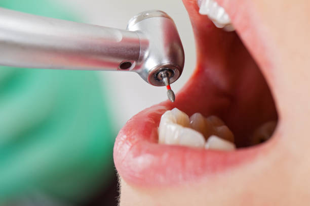 Best Emergency Dentist for Knocked-Out Tooth in Vernon, WI